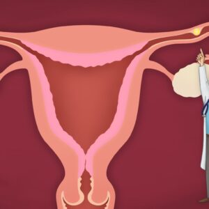 Внематочная беременность